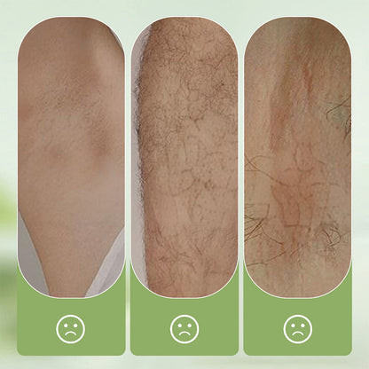 Gentle and Non-Irritating Hair Removal Cream|Limited-time offer🎁